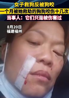 福州一女子救狗反被狗咬