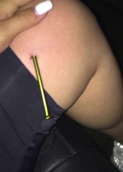 男子夜市玩网红游戏砸钉子 钉子弹出扎入女子大腿