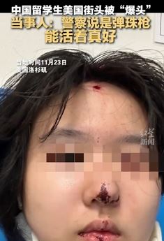中国留学生美国街头被人用弹珠枪爆头