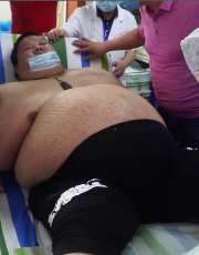 武汉一男子体重达278公斤 因呼吸困难被送医