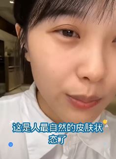 网红黄老现分享无美颜无滤镜素颜最真实的模样