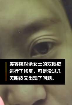 女子美容院做双眼皮变"三眼皮"，眼皮掉出根铁丝状东西