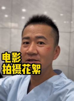 演员李嘉明快手发电影拍摄花絮，脸上胳膊上的伤都这样"造假"来的！