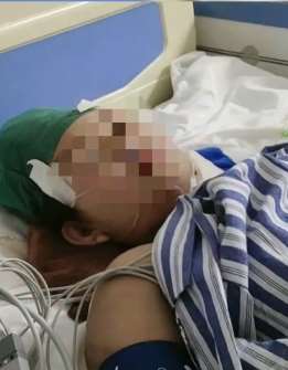 辽宁一17岁少年行凶致一死一伤