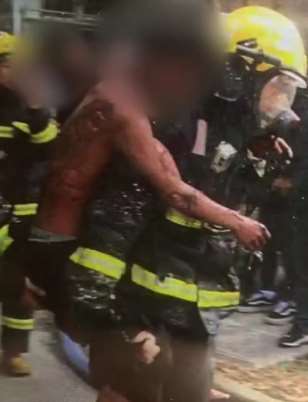 杭州一小区住户因电瓶燃爆引发火灾，3人被烧伤！