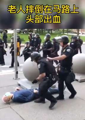 美国警察把老人推倒头部出血