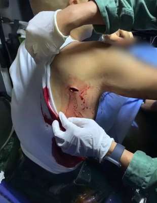 乱港暴徒围攻警察 一名警员被刀刺伤