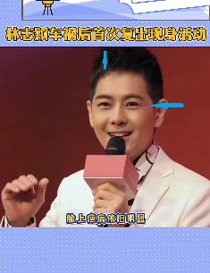 林志颖车祸后首次公开活动现场与粉丝互动 模样略有改变