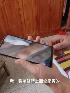 6岁女童疑遭母亲情夫虐打 警方：嫌疑人已被刑拘！