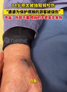 为保护游客84岁师太被独臂猴咬伤