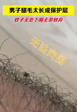 男子腿毛太长蚊子无处下嘴