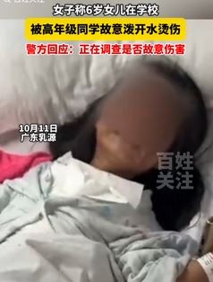 6岁女孩在学校被高年级同学故意泼开水烫伤