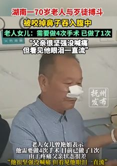 湖南一7旬岁老人勇斗歹徒被咬掉鼻子
