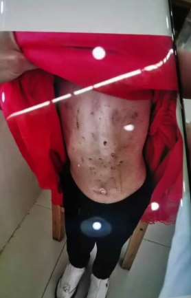 四岁女童遭后妈虐待 涉事女子被抓后供认不讳