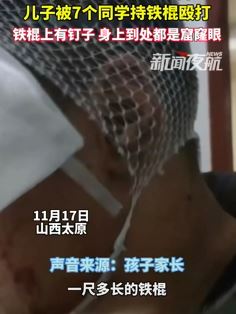 太原一家长曝儿子被7个同学持棍殴打