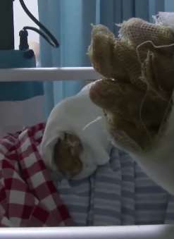 天降横祸！深圳一女子在家中被雷击中烧伤！