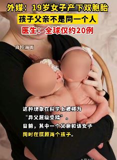 巴西一女子产下双胞胎 但孩子父亲不是同一个人