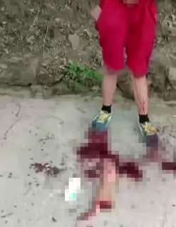 湖南一男子被车撞断左臂，太吓人了！