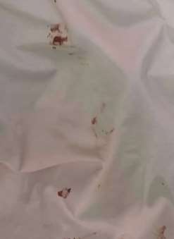 太原：留学生曝隔离酒店卫生环境差 床单有血渍