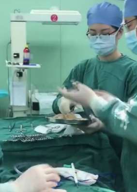 江苏一女士隆胸30年后假体破裂 多处组织坏死
