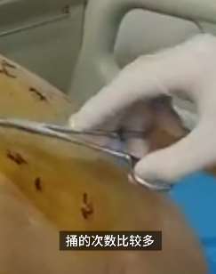 初中女生因看同学纸条起冲突被连捅数刀