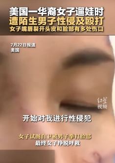 美国一华裔女子遛娃遭陌生男子性侵殴打
