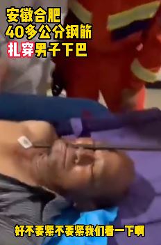 合肥一男子下巴被钢筋扎穿 消防员暖心救援
