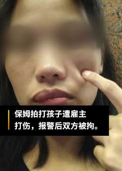深圳一保姆因打掐孩子被雇主打伤