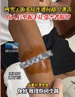 武汉2男子遭同一问路人袭击划伤手臂