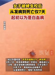 江苏一女子被蜱虫咬后发病到死亡仅7天 起初以为是白血病