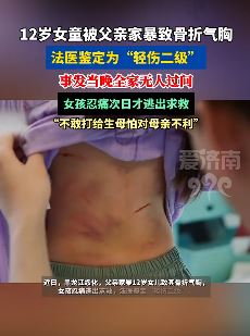 12岁女童被父亲家暴致骨折气胸