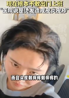 呼和浩特一女子称烫发后几乎秃顶