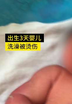青岛一新生儿洗澡被烫伤 转至上海治疗后涉事医院拒赔付