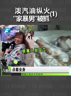 女子惨遭男友泼汽油后严重烧伤