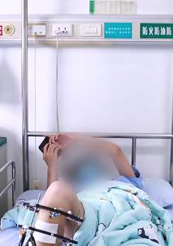 武汉一14岁少年右腿比左腿短5cm 骨延长技术助其拉长右腿
