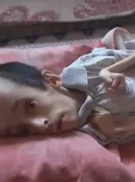 印度一12岁男孩得怪病瘦的只剩眼睛会动