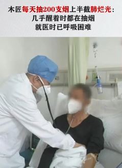 男子每日抽10包烟两个肺上半截烂光