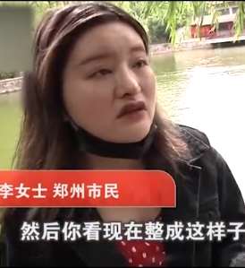 女子整容失败，鼻子整容完后像鸟嘴！