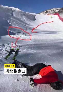 河北张家口云顶滑雪场一滑雪者摔倒身亡