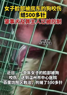 温州一女子脸部被狗咬伤缝500多针 肇事犬及其主人被控制