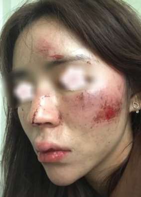 成都一女子深夜遭调戏殴打  头部及面部多处受伤！