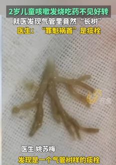 2岁男童咳嗽发烧不止竟因气管里“长树”