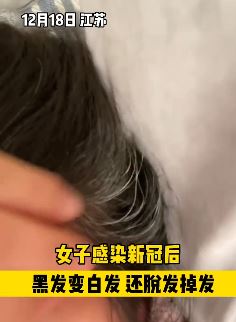 江苏一女子感染新冠后头发变白