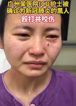医院回应护士被外籍男子殴打咬伤