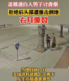 美亚裔女子凌晨遭袭击右耳撕裂