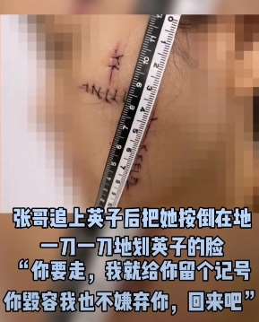 杭州一男子带前女友到墓地用刀划其脸