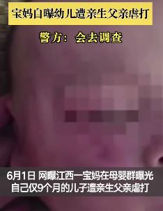 宝妈曝9个月婴儿遭亲生父亲虐打