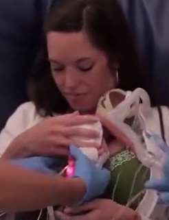 世界上最小婴儿 出生只有巴掌大小！