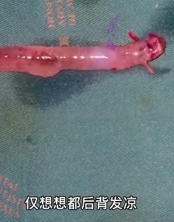 亚马逊雨林究竟有多可怕？隐藏7大杀手各个令人毛骨悚然！