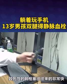 13岁男孩长时间躺着玩手机患静脉血栓